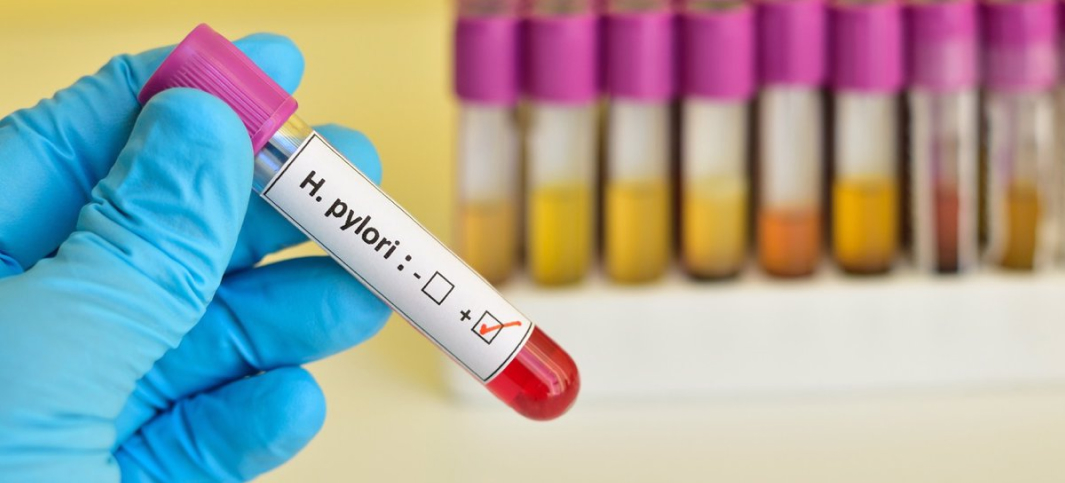 Purification of Total RNA from Helicobacter pylori Using Stomach Biopsies from Infected Patients