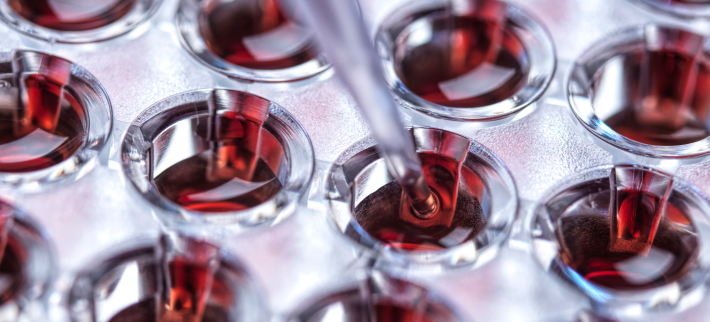 Cytological centrifugation for the concentration of clinical samples